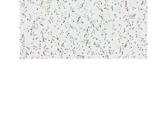 Suspended Ceiling Tiles for Sale